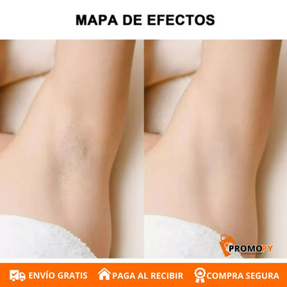 DEPILADORA MULTIUSOS PORTÁTIL